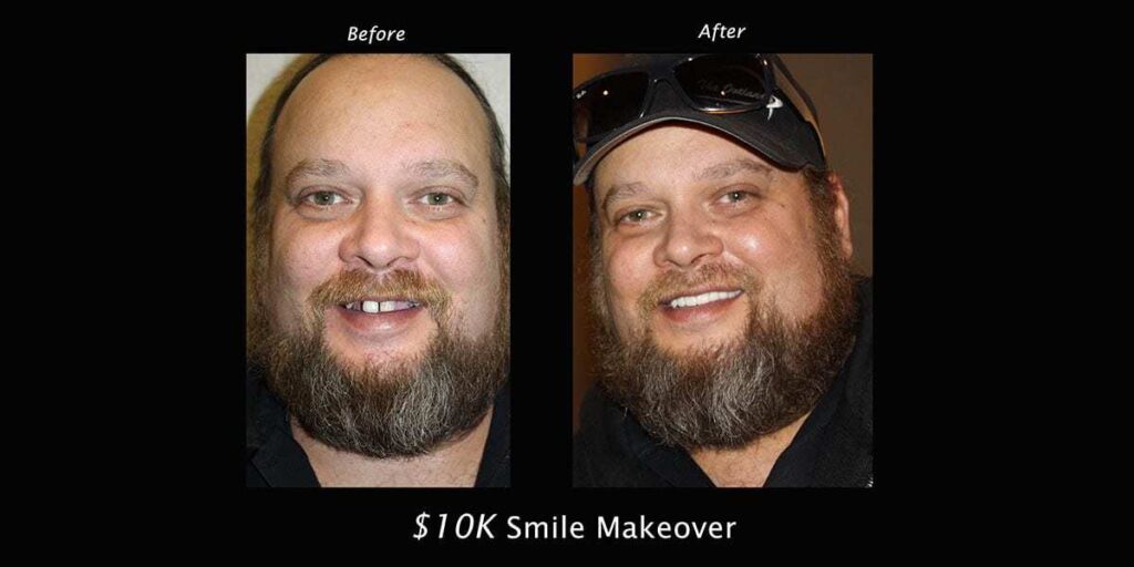 $10,000 Smile Giveaway