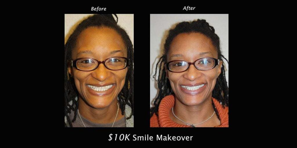 $10,000 Smile Giveaway