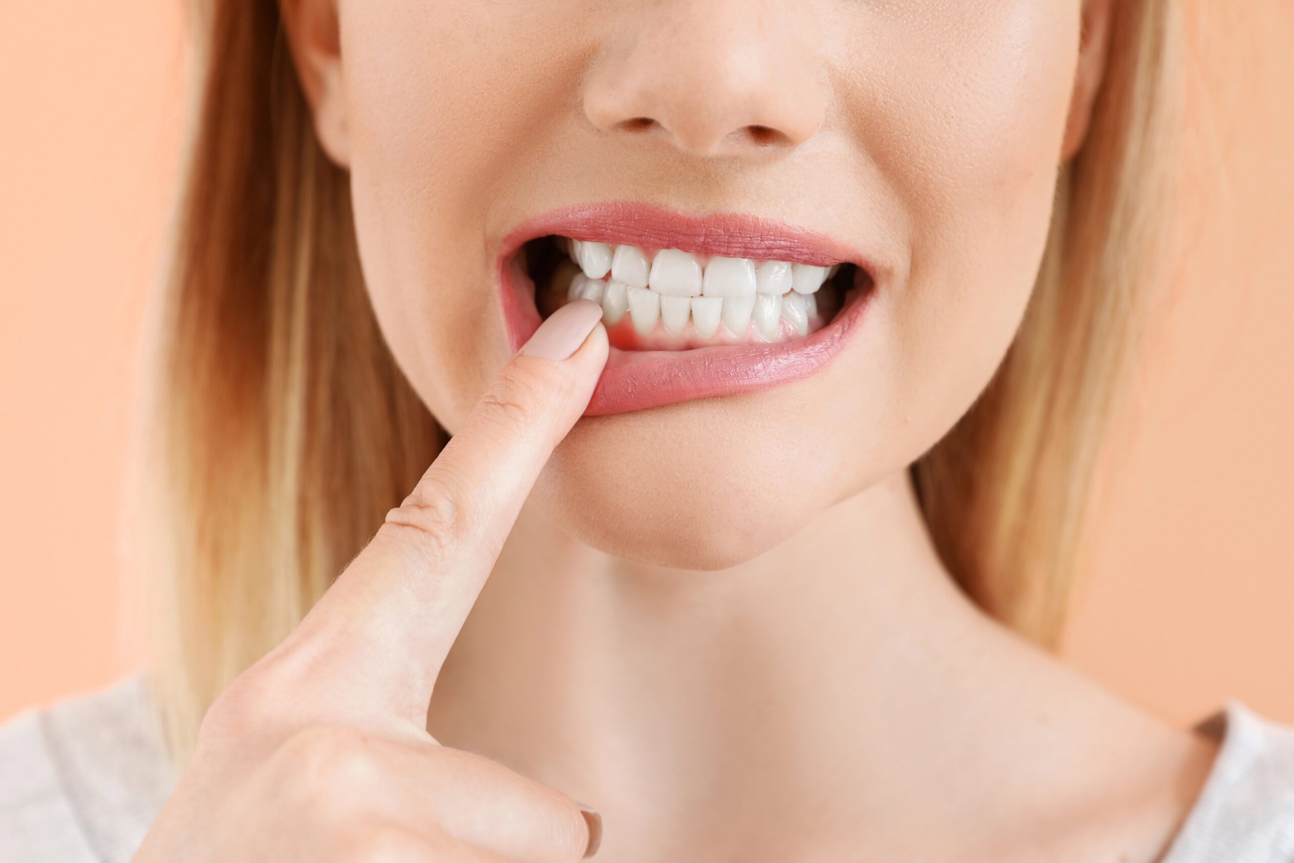 Cropped photo of young woman pointing at her teeth and gums