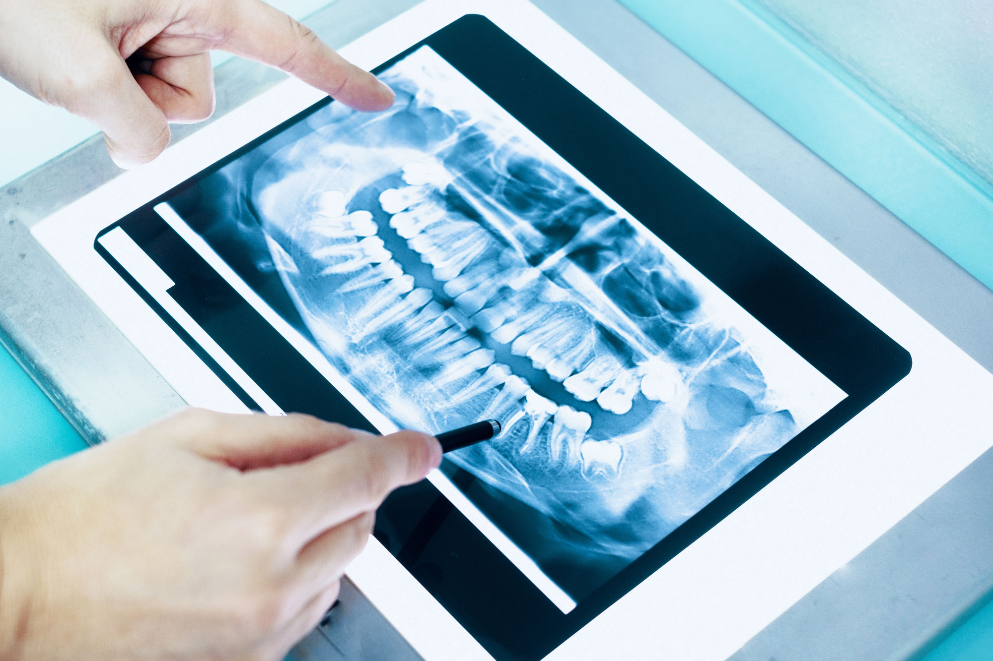 Dentist-examining-dental-x-ray-in-his-clinic-lab-