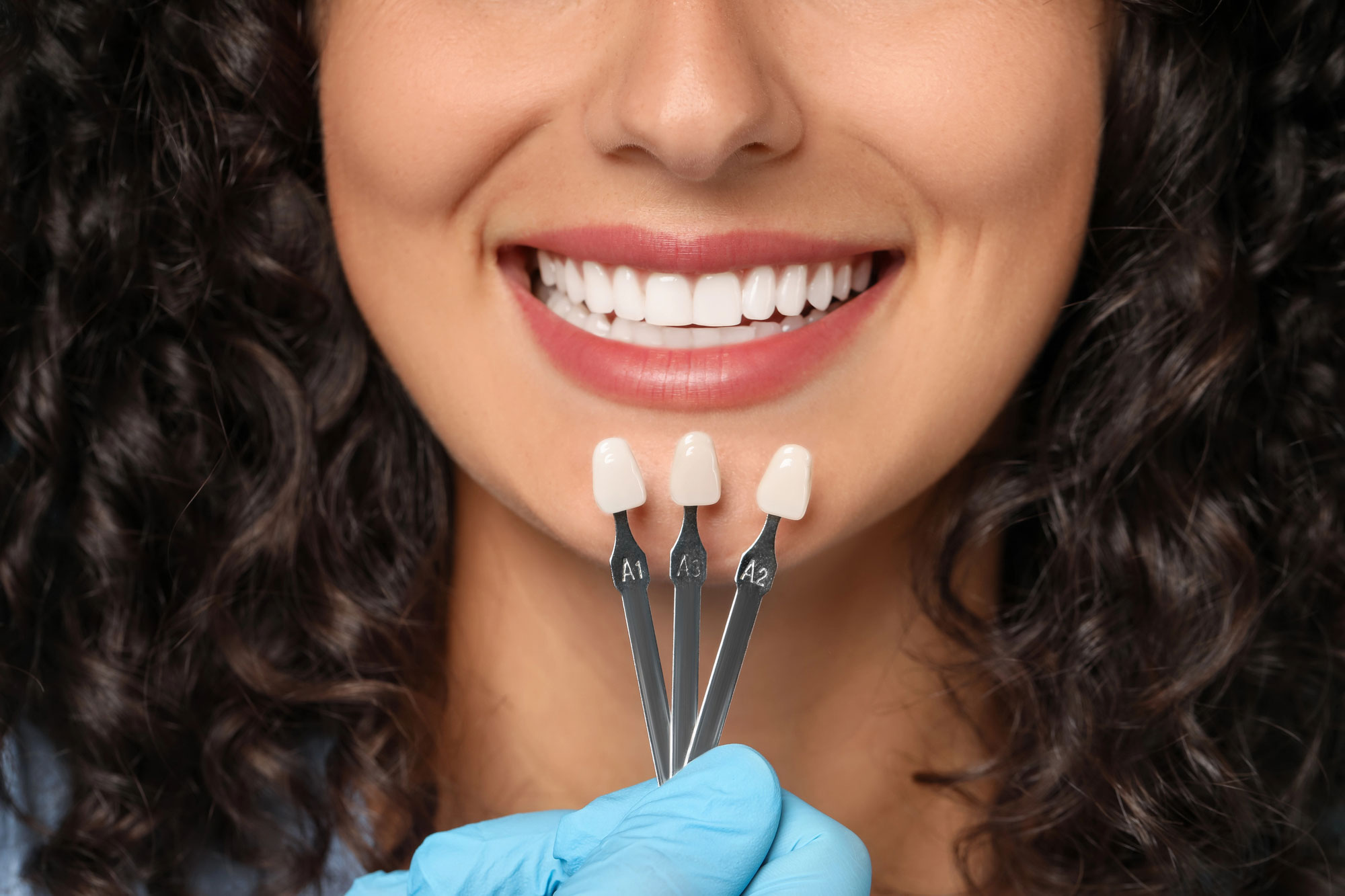 Doctor checking young woman's teeth color, closeup