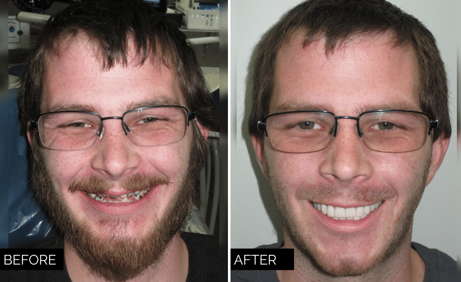 James-Eastland-Smile-Gallery-Denture