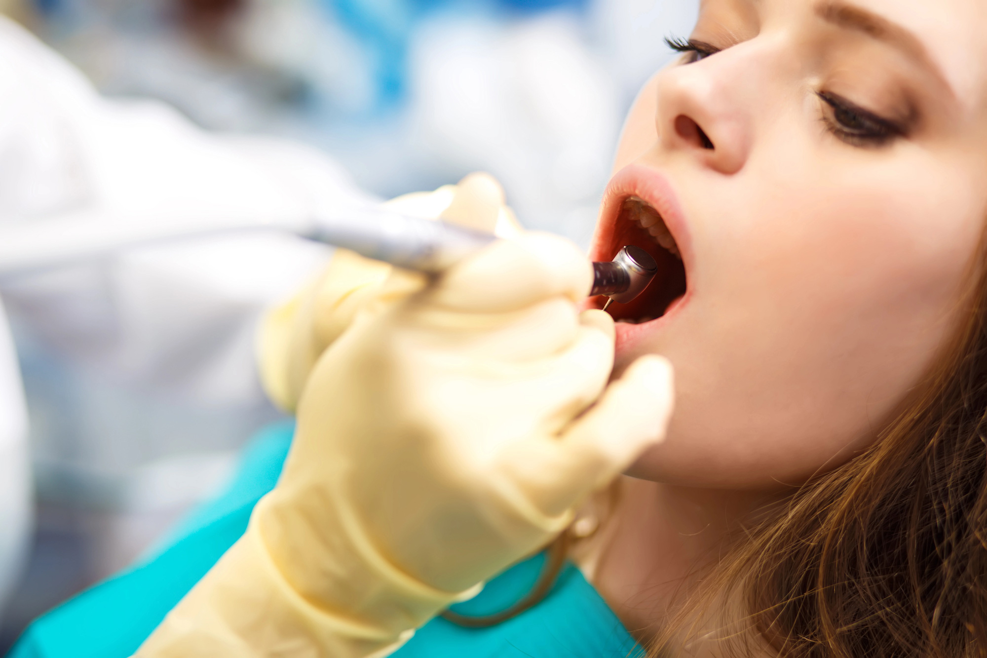 Overview-of-dental-caries-prevention
