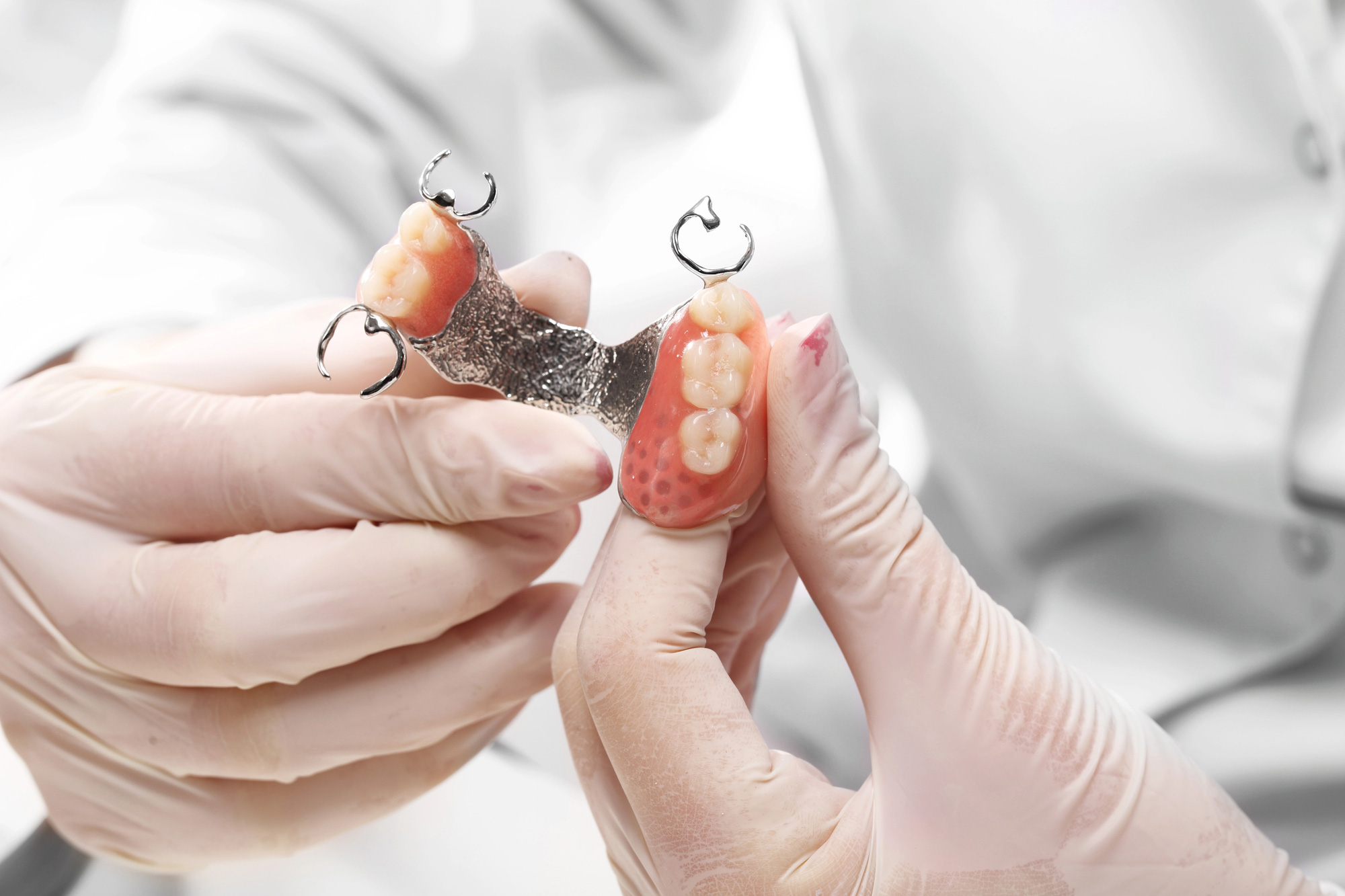 Veneers,-dentures,-bridges-