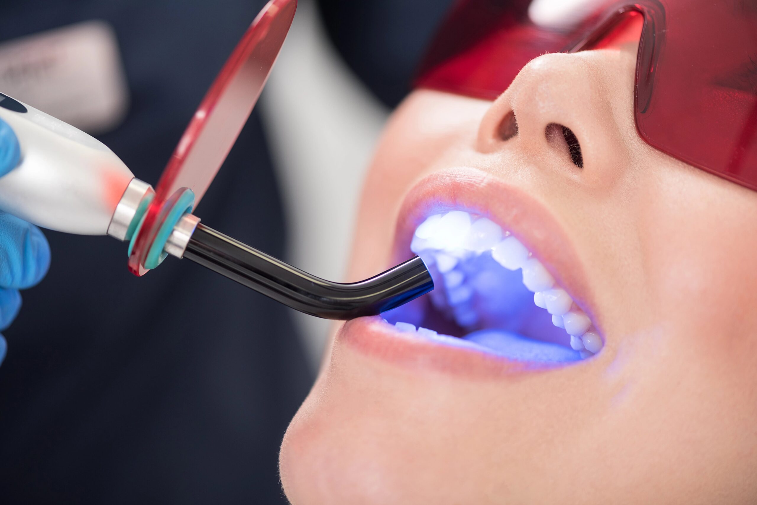 Woman at dentist having bonded tooth cured by light