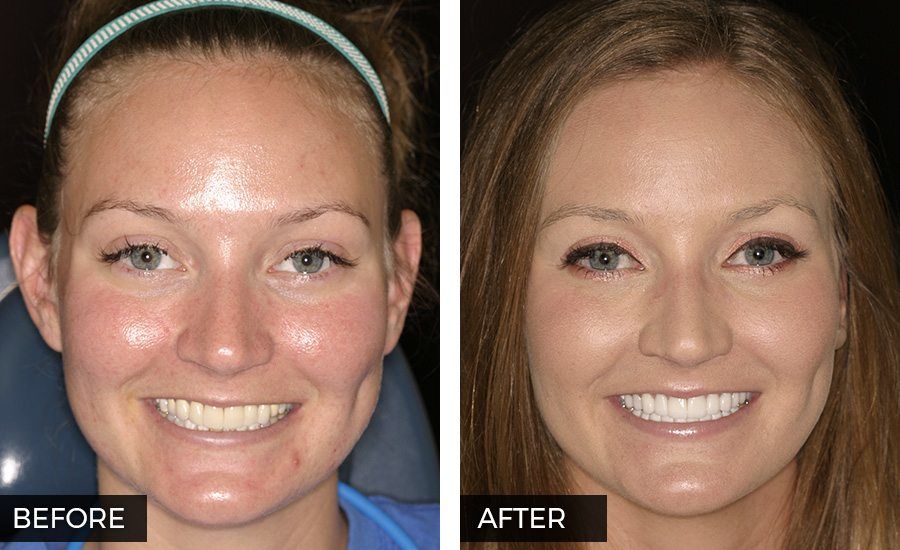 Before and after photo 1